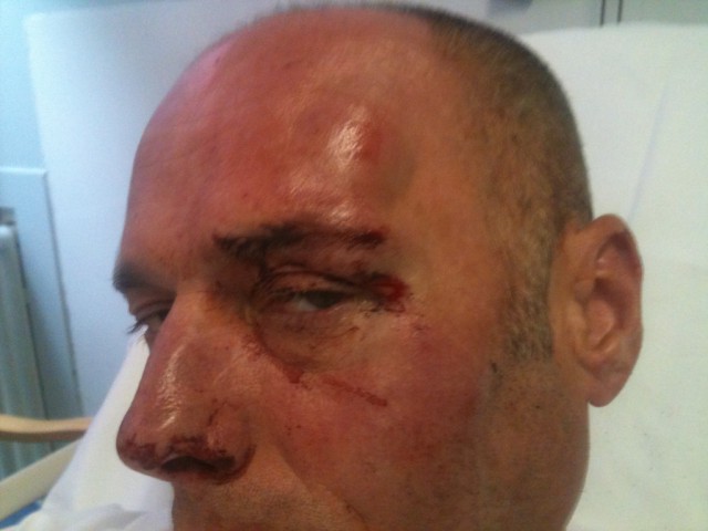 me in hospital after blacking out!